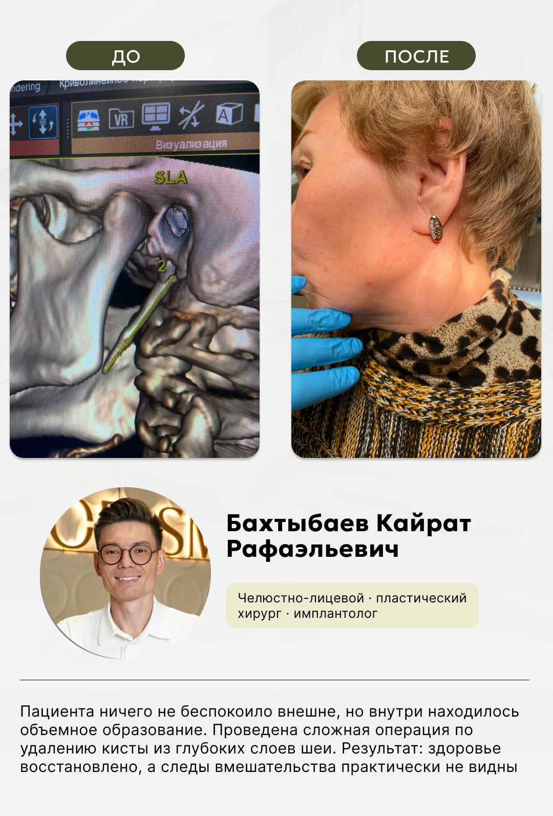 Челюстно-лицевая хирургия, фото 6