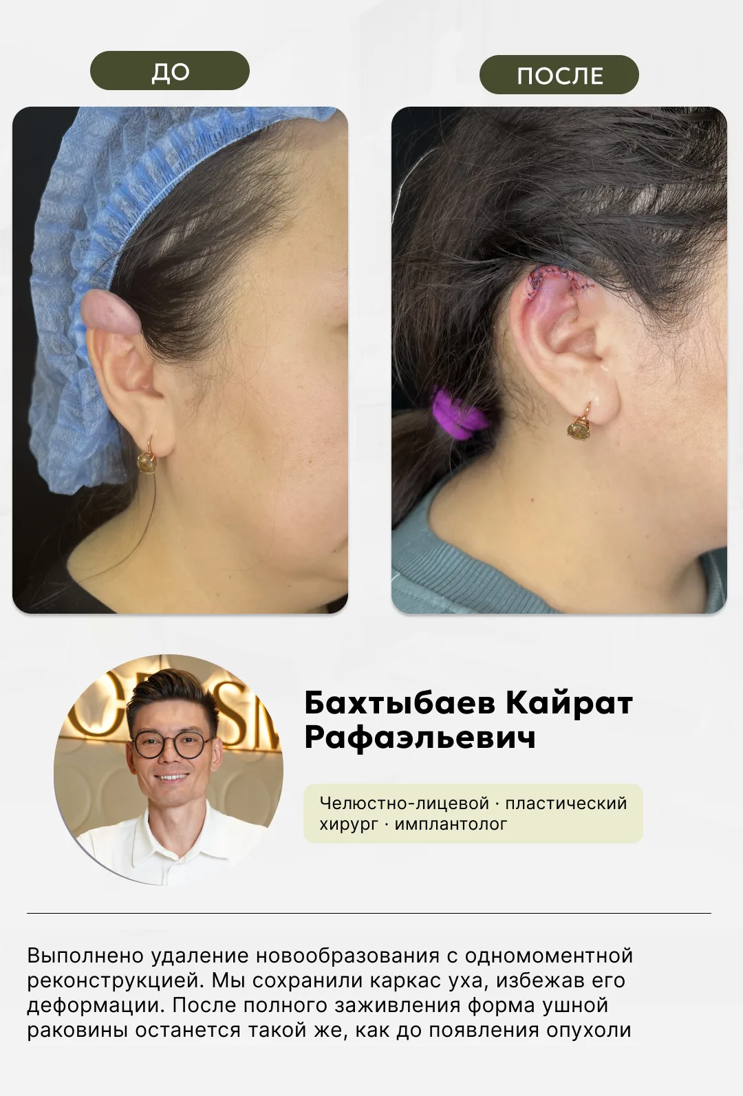 Челюстно-лицевая хирургия, фото 7