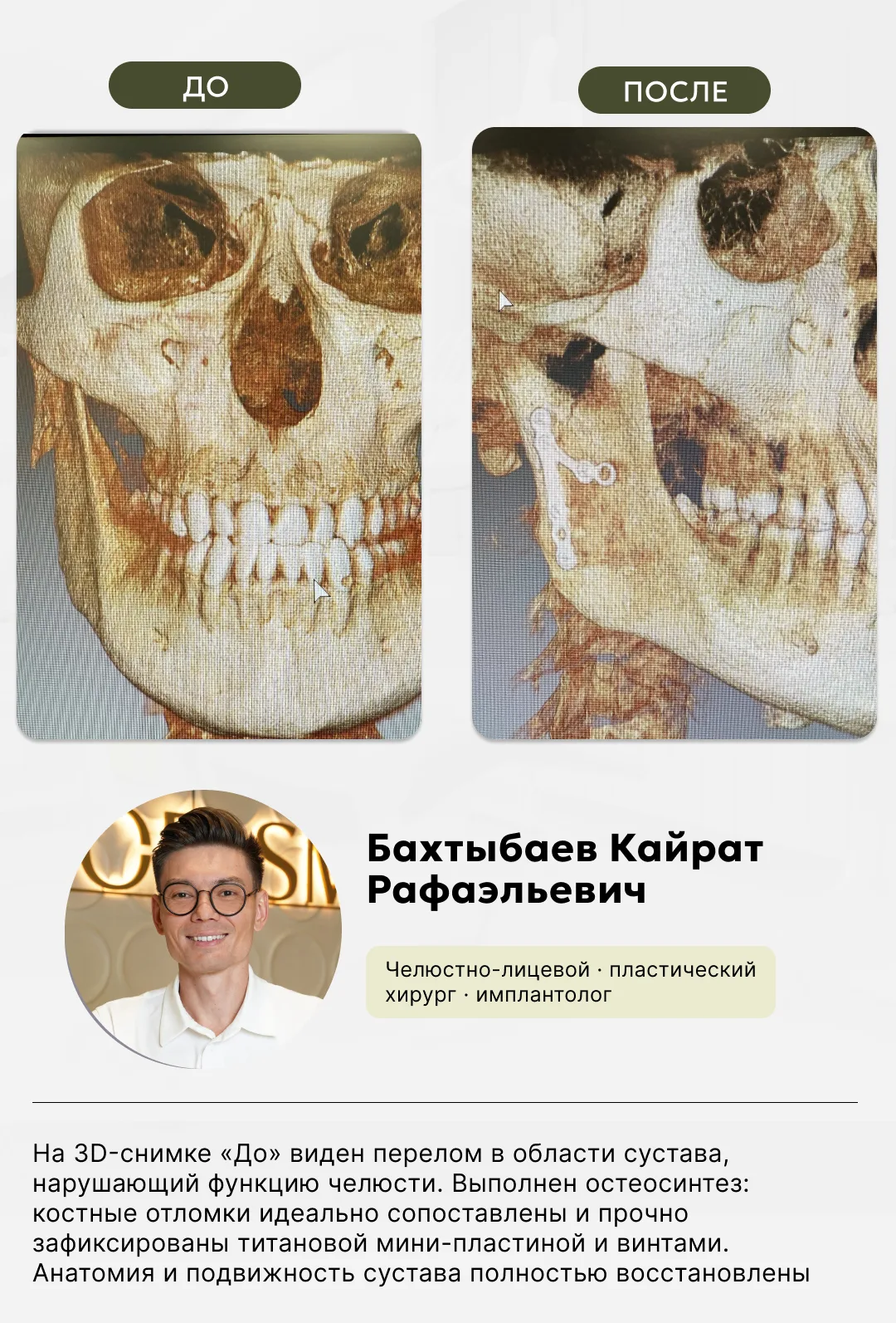 Челюстно-лицевая хирургия, фото 5