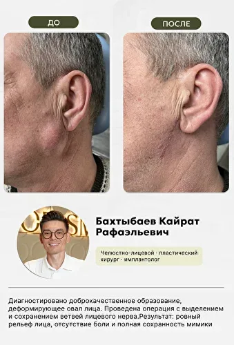 Челюстно-лицевая хирургия, фото 1