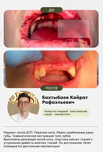 Челюстно-лицевая хирургия, фото 4